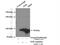 FER Tyrosine Kinase antibody, 25287-1-AP, Proteintech Group, Immunoprecipitation image 