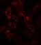 ADP Ribosylation Factor 6 antibody, A00927, Boster Biological Technology, Immunofluorescence image 