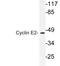 Cyclin E2 antibody, LS-C177744, Lifespan Biosciences, Western Blot image 