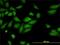 Rho Associated Coiled-Coil Containing Protein Kinase 2 antibody, H00009475-M01, Novus Biologicals, Immunocytochemistry image 