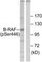 B-Raf Proto-Oncogene, Serine/Threonine Kinase antibody, PA5-39730, Invitrogen Antibodies, Western Blot image 