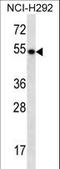 TBC1 Domain Family Member 3F antibody, LS-C203704, Lifespan Biosciences, Western Blot image 