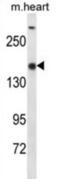 SET Domain Containing 1B, Histone Lysine Methyltransferase antibody, abx026794, Abbexa, Western Blot image 