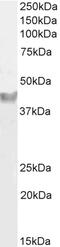 Carboxylesterase 1 antibody, 46-640, ProSci, Western Blot image 