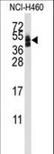 CXADR Ig-Like Cell Adhesion Molecule antibody, LS-C97350, Lifespan Biosciences, Western Blot image 