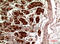 Telomerase Reverse Transcriptase antibody, A00012-2, Boster Biological Technology, Immunohistochemistry paraffin image 