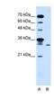 Glycolipid Transfer Protein Domain Containing 2 antibody, NBP1-80543, Novus Biologicals, Western Blot image 