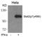 Signal Transducer And Activator Of Transcription 2 antibody, GTX50721, GeneTex, Western Blot image 