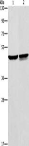 Alpha-Methylacyl-CoA Racemase antibody, CSB-PA418436, Cusabio, Western Blot image 