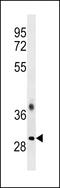 Transformer 2 Beta Homolog antibody, 57-916, ProSci, Western Blot image 