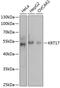 Keratin 17 antibody, 13-043, ProSci, Western Blot image 