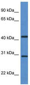 Alkaline Ceramidase 1 antibody, TA343070, Origene, Western Blot image 