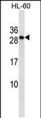 Transmembrane P24 Trafficking Protein 6 antibody, PA5-48783, Invitrogen Antibodies, Western Blot image 