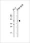 Acid Phosphatase 6, Lysophosphatidic antibody, 61-271, ProSci, Western Blot image 