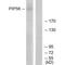 Phosphoinositide Kinase, FYVE-Type Zinc Finger Containing antibody, A02638-1, Boster Biological Technology, Western Blot image 