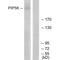 Phosphoinositide Kinase, FYVE-Type Zinc Finger Containing antibody, A02638-1, Boster Biological Technology, Western Blot image 