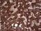 Sorting Nexin 16 antibody, A11003, Boster Biological Technology, Immunohistochemistry paraffin image 