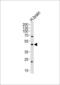 Abhydrolase Domain Containing 12 antibody, MBS9200845, MyBioSource, Western Blot image 