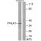 Pleckstrin Homology Like Domain Family A Member 1 antibody, A05823, Boster Biological Technology, Western Blot image 