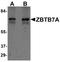 ZBTB7A antibody, PA5-21087, Invitrogen Antibodies, Western Blot image 