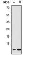 Adrenodoxin, mitochondrial antibody, LS-C667688, Lifespan Biosciences, Western Blot image 