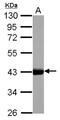 Keratin-17 antibody, NBP1-32824, Novus Biologicals, Western Blot image 