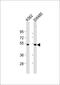 Protein Kinase CAMP-Dependent Type II Regulatory Subunit Alpha antibody, M03911-1, Boster Biological Technology, Western Blot image 