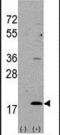 Hippocalcin Like 1 antibody, PA5-11652, Invitrogen Antibodies, Western Blot image 