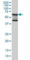 TGF-Beta Activated Kinase 1 (MAP3K7) Binding Protein 1 antibody, H00010454-M03, Novus Biologicals, Western Blot image 