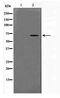 Ceramide Kinase Like antibody, TA347717, Origene, Western Blot image 