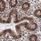 Cullin 5 antibody, NBP1-86868, Novus Biologicals, Immunohistochemistry paraffin image 