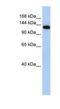 Myosin Binding Protein C, Fast Type antibody, NBP1-70646, Novus Biologicals, Western Blot image 
