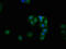 Glycogen Synthase 1 antibody, CSB-RA010078A641phHU, Cusabio, Immunofluorescence image 
