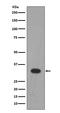 Lin-28 Homolog B antibody, M00896, Boster Biological Technology, Western Blot image 