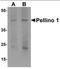 Pellino E3 Ubiquitin Protein Ligase 1 antibody, orb137371, Biorbyt, Western Blot image 