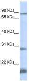 SET And MYND Domain Containing 4 antibody, TA339782, Origene, Western Blot image 