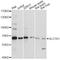 Solute Carrier Family 7 Member 1 antibody, LS-C749764, Lifespan Biosciences, Western Blot image 