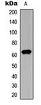 Checkpoint Kinase 2 antibody, orb235095, Biorbyt, Western Blot image 