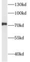 NUAK Family Kinase 1 antibody, FNab00570, FineTest, Western Blot image 