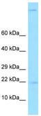 Gastrokine 2 antibody, TA337725, Origene, Western Blot image 