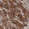 Adipogenesis Associated Mth938 Domain Containing antibody, NBP2-31969, Novus Biologicals, Immunohistochemistry frozen image 