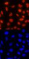 DNA Topoisomerase II Beta antibody, MAB6348, R&D Systems, Immunocytochemistry image 