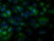 Bruton Tyrosine Kinase antibody, GTX84789, GeneTex, Immunofluorescence image 