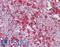 Signal Induced Proliferation Associated 1 Like 3 antibody, LS-B15494, Lifespan Biosciences, Immunohistochemistry paraffin image 