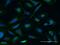 Centrin 3 antibody, H00001070-B01P, Novus Biologicals, Immunocytochemistry image 