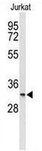 Transmembrane Protein 150A antibody, AP54132PU-N, Origene, Western Blot image 