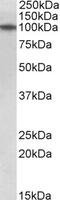 Ribosomal Protein S6 Kinase A2 antibody, 42-756, ProSci, Western Blot image 