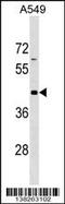 G Protein-Coupled Receptor 62 antibody, 59-637, ProSci, Western Blot image 