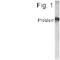 Solute Carrier Family 45 Member 3 antibody, PA1-4230, Invitrogen Antibodies, Western Blot image 