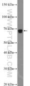 Neurofibromin 2 antibody, 10659-1-AP, Proteintech Group, Western Blot image 